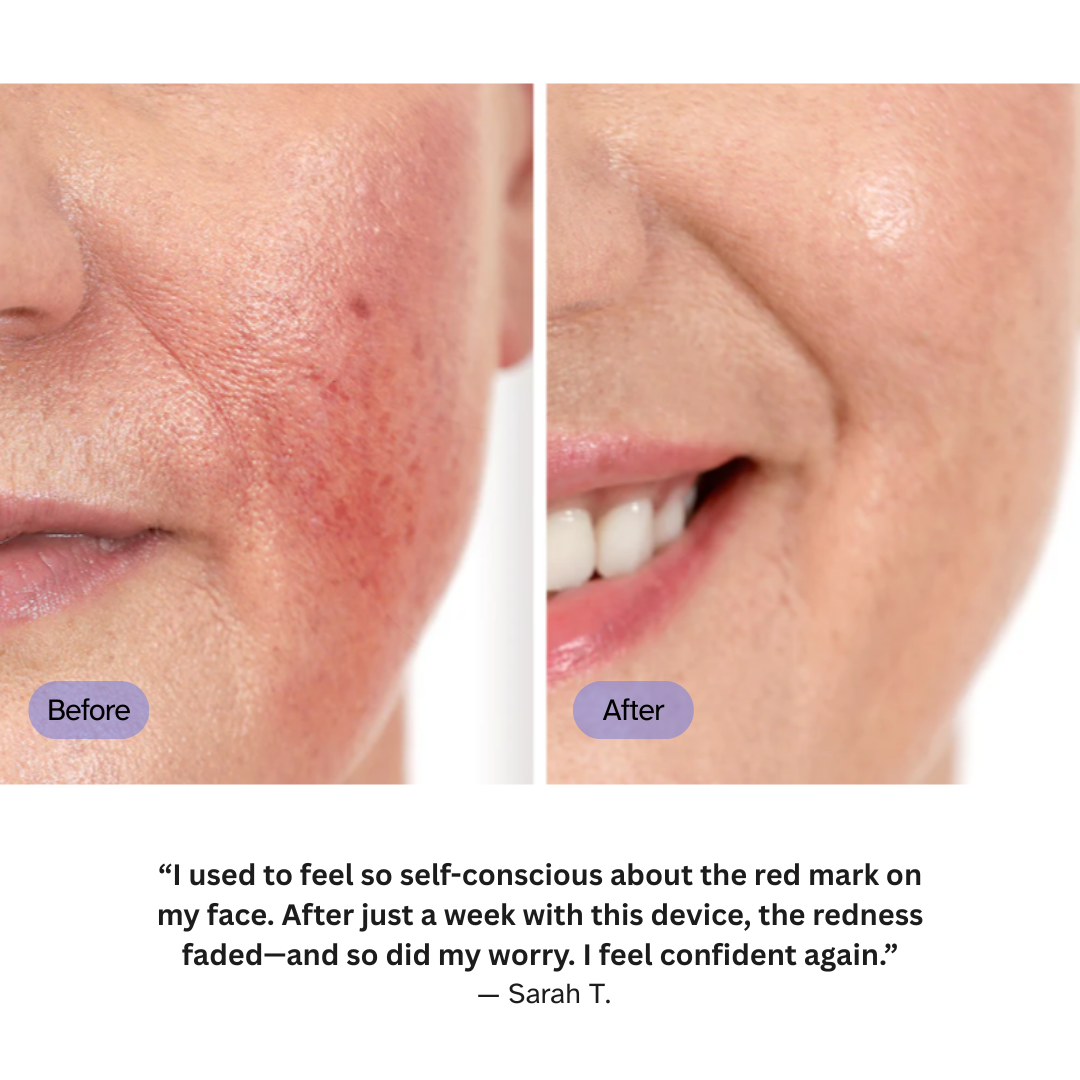 Anti-aging LED Light Therapy