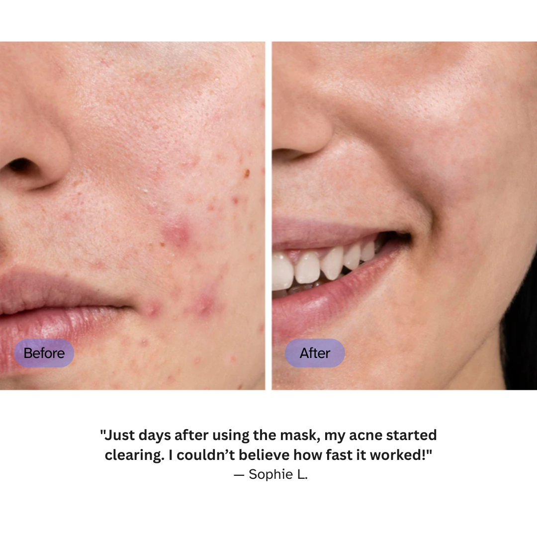 Anti-aging LED Light Therapy