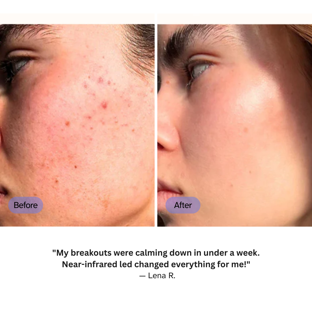 Anti-aging LED Light Therapy